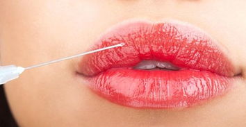 自体脂肪丰唇的的术后护理,丰唇的效果