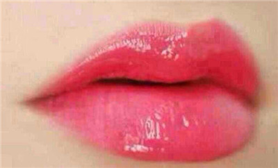 漂唇前需要注意哪些,漂唇术,漂唇术全过程