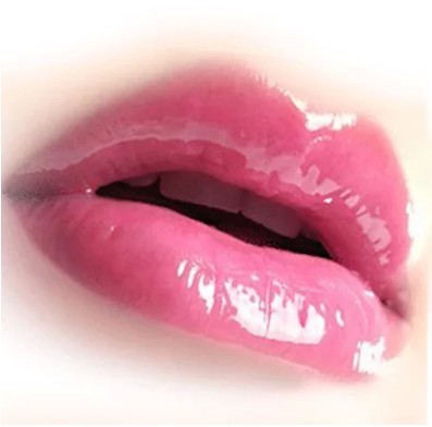 丰唇手术的方法,胶原蛋白丰唇,自体脂肪丰唇,玻尿酸丰唇