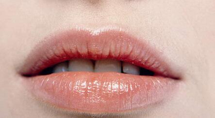 玻尿酸丰唇需要打几针,丰唇的效果