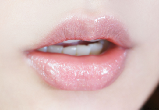 玻尿酸丰唇后的注意事项