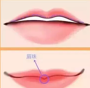 丰唇珠的方法有哪些，玻尿酸丰唇珠，自体脂肪移植丰唇珠， 什么样的唇是美唇，