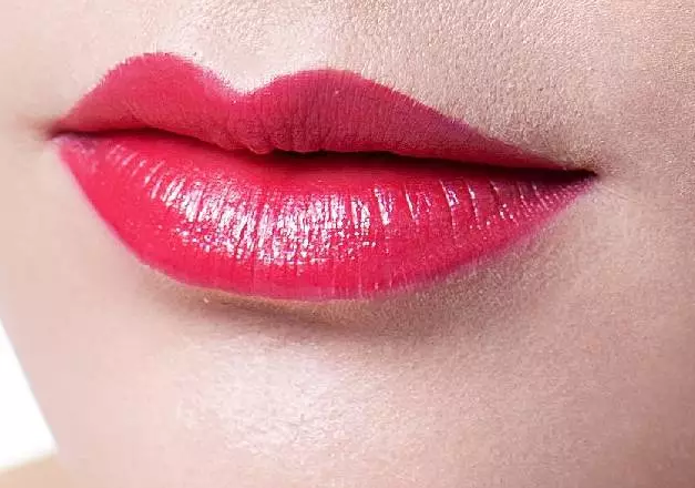 丰唇后多久能涂口红呢，玻尿酸丰唇后的护理，玻尿酸丰唇后还要注意什么