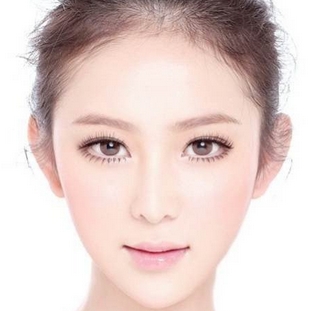 双下巴吸脂效果好不好,吸脂手术