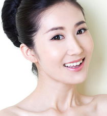 双下巴吸脂的优点,双下巴吸脂术