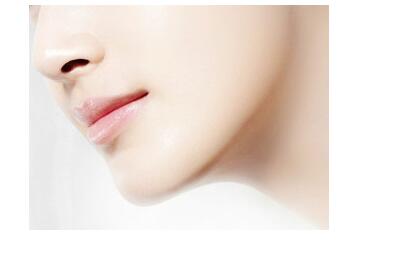 下巴吸脂后会留疤吗