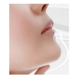 自体脂肪丰下巴后的注意事项