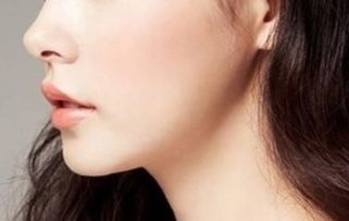 假体丰下巴手术后的恢复时间