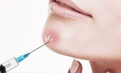 玻尿酸丰下巴的后遗症