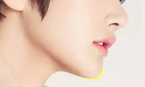 长沙丰下巴的价格