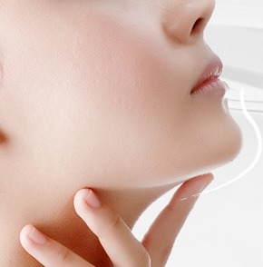 玻尿酸垫下巴能维持多久