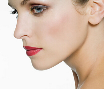 面部提升术的特点