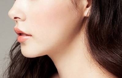 垫下巴术后到底有没有副作用