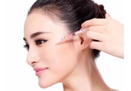 注射玻尿酸丰太阳穴的优势