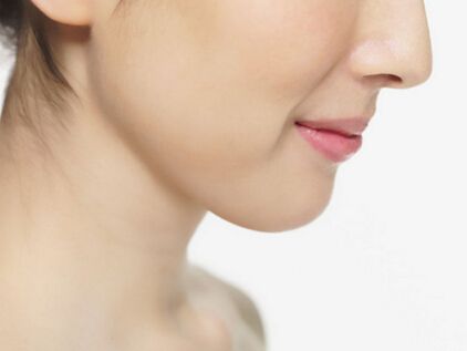 改脸型截骨和磨骨