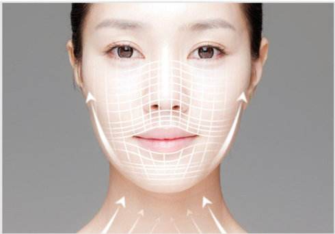 微拉美面部提升后能维持多久