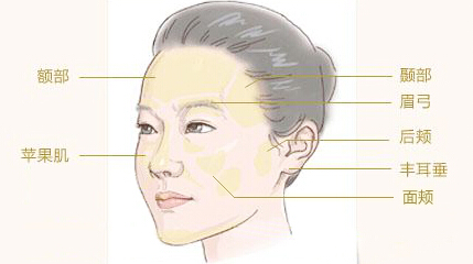 自体脂肪面部填充