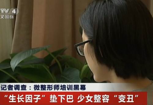 安全隆下巴方法有4种 为何她隆下巴后出问题