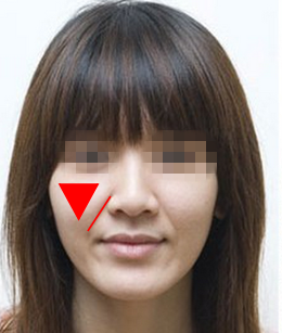 苹果肌和法令纹在哪里？