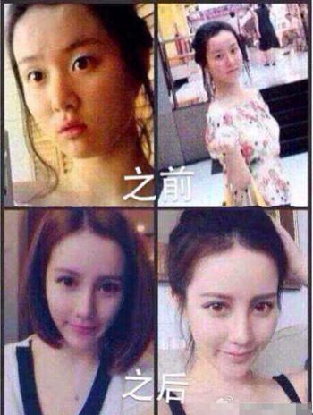 能让“路人”变“女神”吗？微整形说“YES”