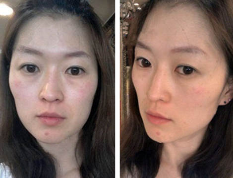 女网友面部太瘦显老