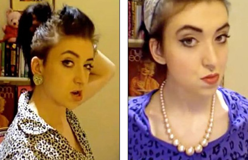 英国女孩因突起下巴遭嘲讽 反颌矫正术让她重获新生