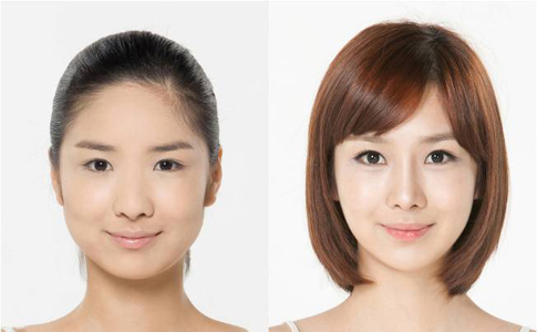 注射瘦脸针多少钱