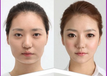 注射瘦脸针医院