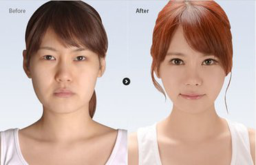 脸部整形多少钱  