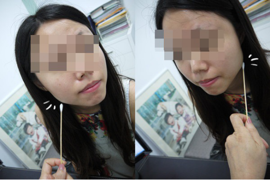 人生首次肉毒素瘦脸体验 我打90分！