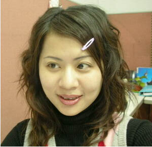 真人讲述：为鹅蛋脸我打了传说中的瘦脸针！