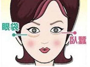 分清眼袋和卧蚕