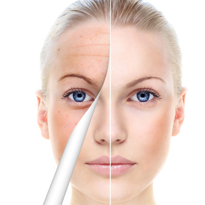 玻尿酸可以祛斑吗,玻尿酸祛斑的效果,