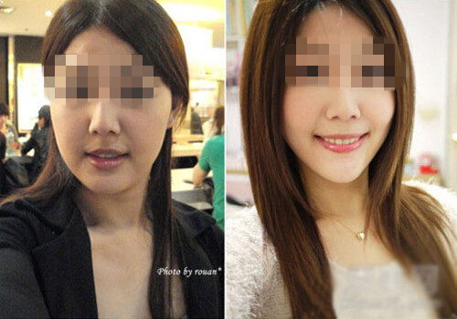 女网友瘦脸前后对比