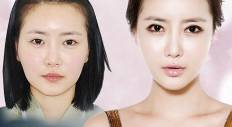 线雕和玻尿酸哪个好