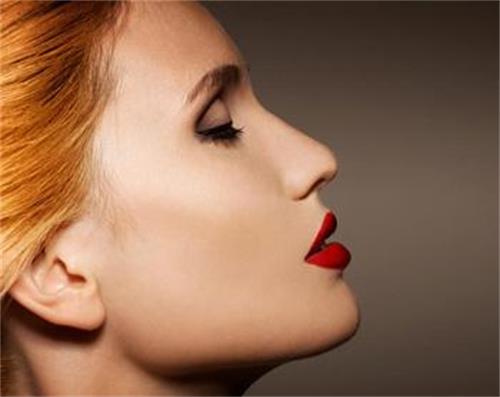 瑞蓝玻尿酸，玻尿酸除皱