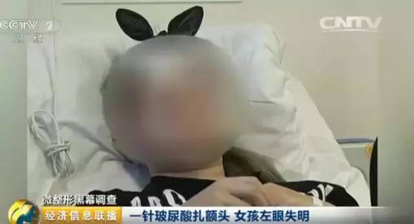非法注射玻尿酸致求美者失明